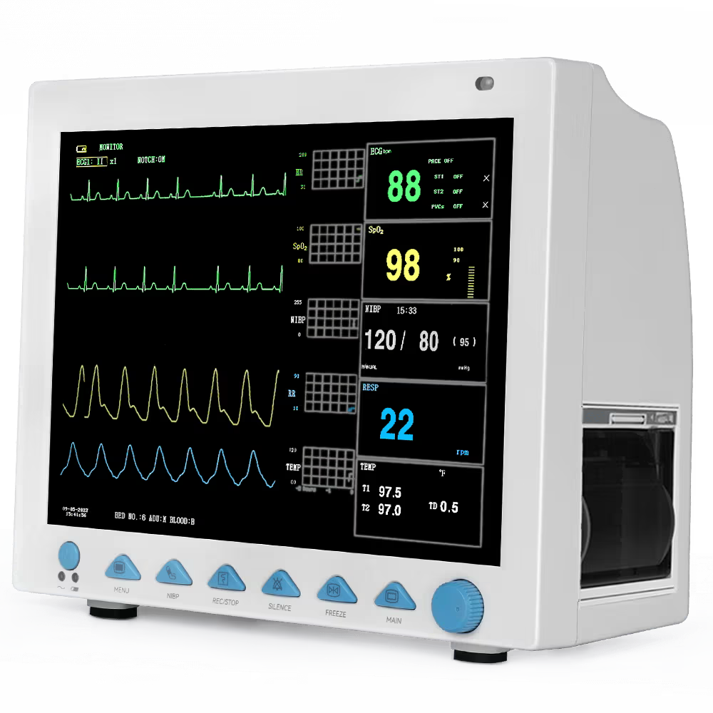 Monitor de ECG